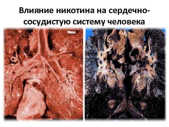 Влияние никотина на сердечнососудистую систему человека 