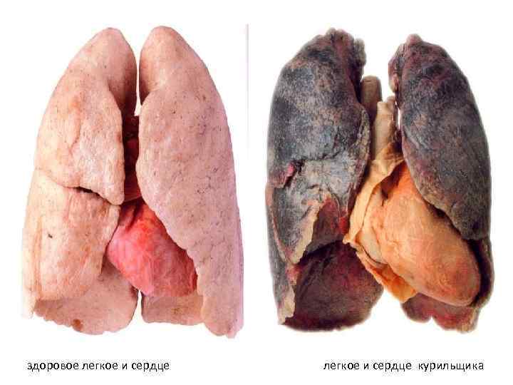 Влияние никотина на организм человека здоровое легкое и сердце курильщика 