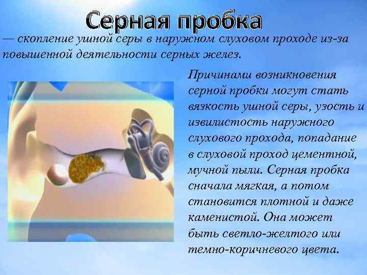Серная пробка проходе из-за — скопление ушной серы в наружном слуховом повышенной деятельности серных