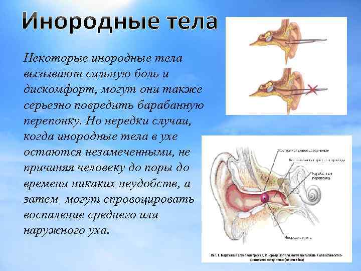 Некоторые инородные тела вызывают сильную боль и дискомфорт, могут они также серьезно повредить барабанную