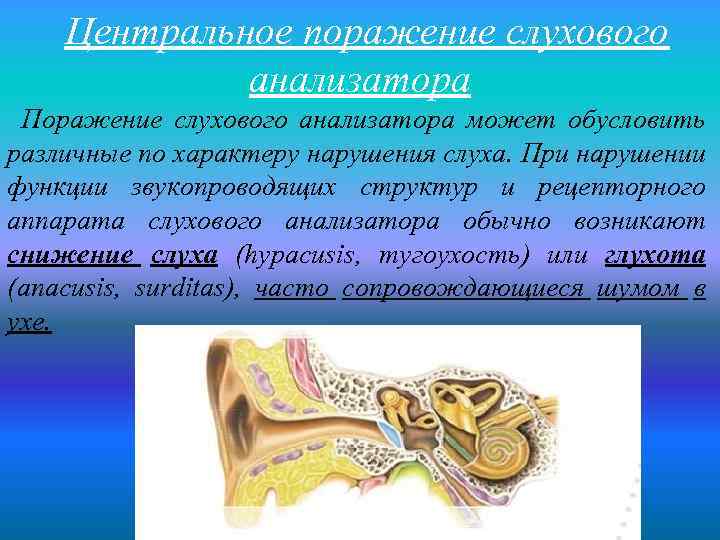 Центральное поражение слухового анализатора Поражение слухового анализатора может обусловить различные по характеру нарушения слуха.