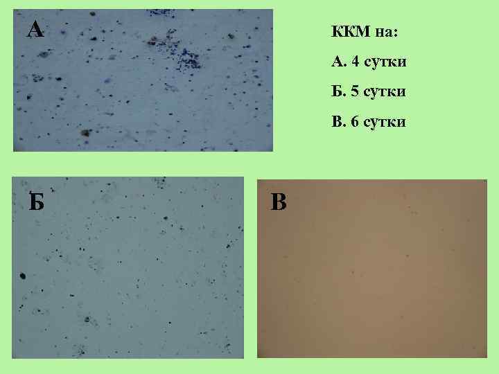 А ККМ на: А. 4 сутки Б. 5 сутки В. 6 сутки Б В