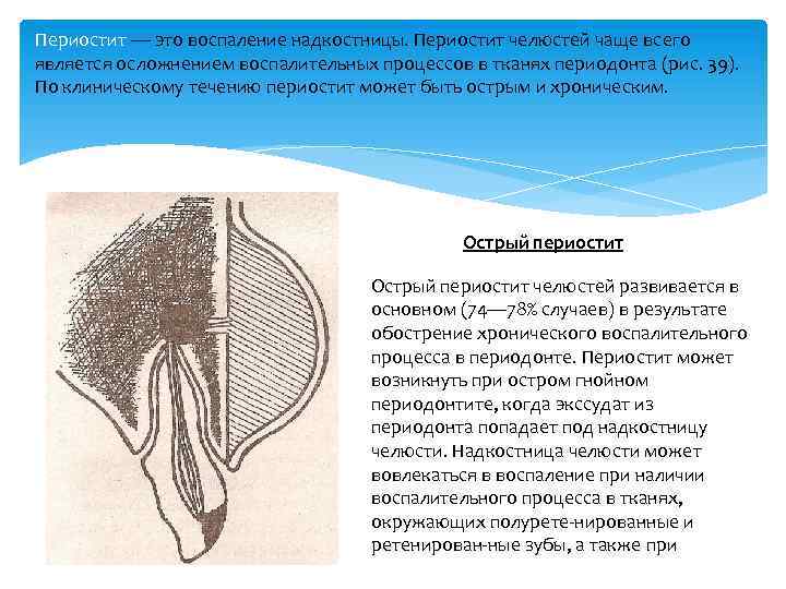 Периостит — это воспаление надкостницы. Периостит челюстей чаще всего является осложнением воспалительных процессов в