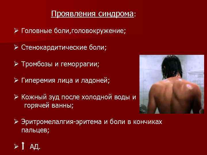 Проявления синдрома: Ø Головные боли, головокружение; Ø Стенокардитические боли; Ø Тромбозы и геморрагии; Ø