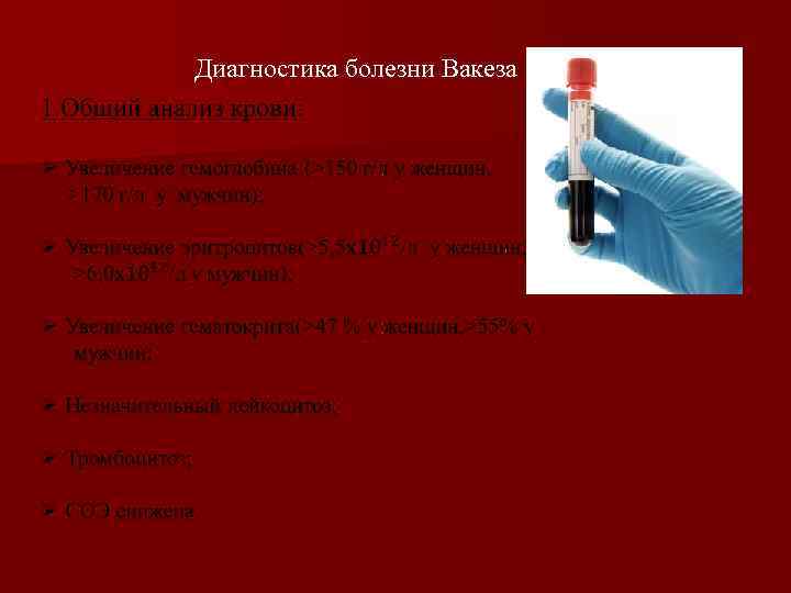 Диагностика болезни Вакеза 