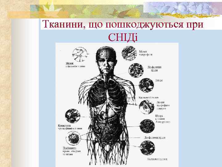 Тканини, що пошкоджуються при СНІДі 