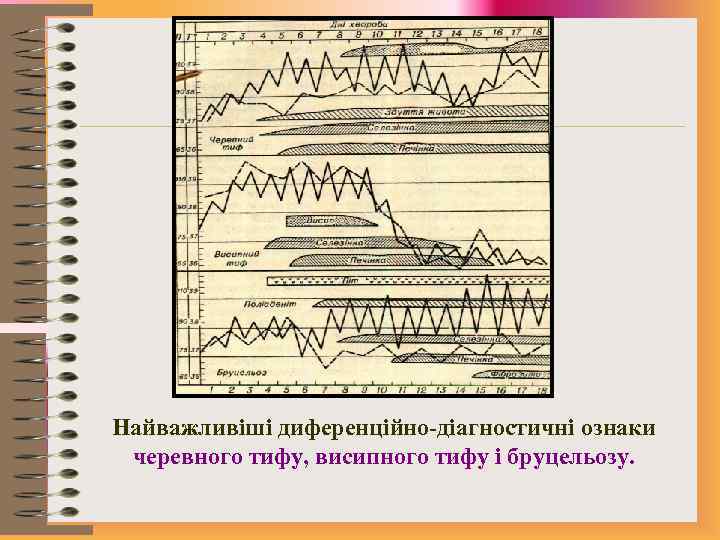 Найважливіші диференційно-діагностичні ознаки черевного тифу, висипного тифу і бруцельозу. 