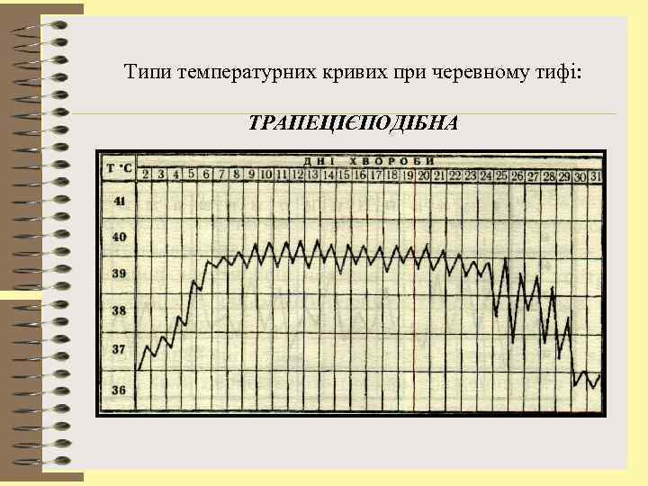 Типи температурних кривих при черевному тифі: ТРАПЕЦІЄПОДІБНА 