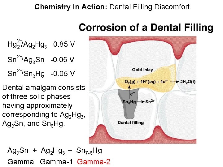 Chemistry In Action: Dental Filling Discomfort 2+ Hg 2 /Ag 2 Hg 3 0.