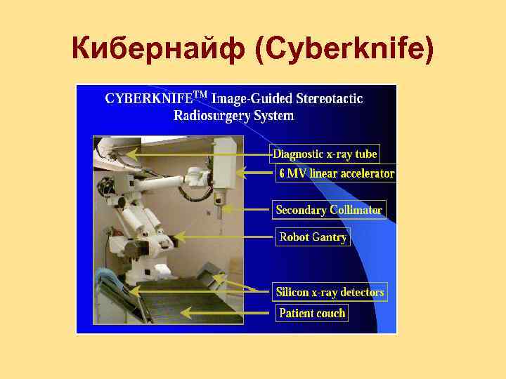 Кибернайф (Cyberknife) 