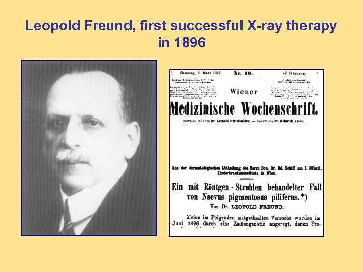 Leopold Freund, first successful X-ray therapy in 1896 