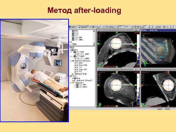 Метод after-loading 