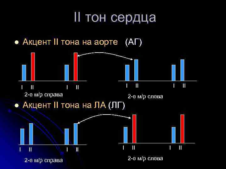 II тон сердца Акцент II тона на аорте (АГ) l I II I 2