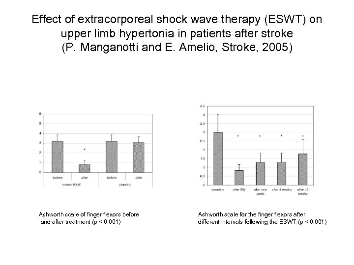 Effect of extracorporeal shock wave therapy (ESWT) on upper limb hypertonia in patients after