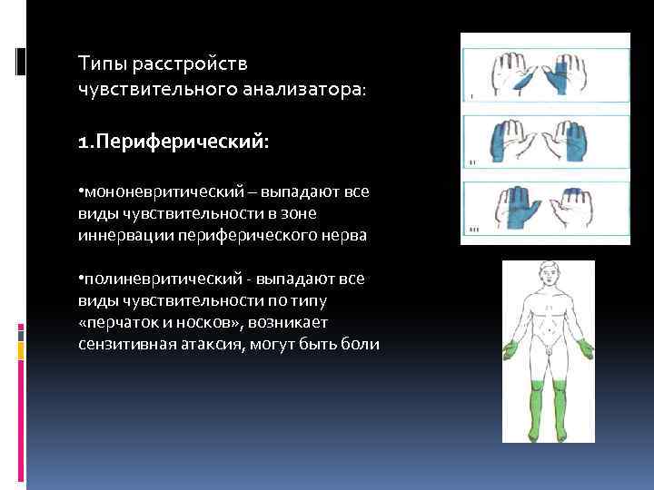 Полиневритический тип расстройства. Периферический мононевритический Тип нарушения чувствительности. Типы нарушения чувствительности неврология. Ганглионарный Тип расстройства чувствительности. Типы растройствчувствительности.