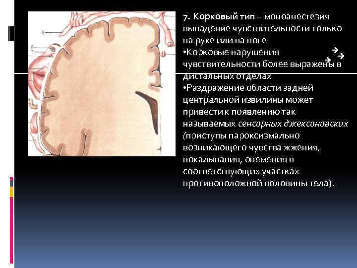 7. Корковый тип – моноанестезия выпадение чувствительности только на руке или на ноге •