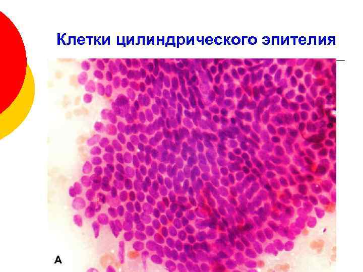 Клетки цилиндрического эпителия nilm