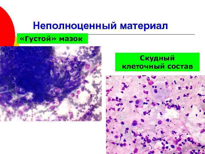 Картина воспаления