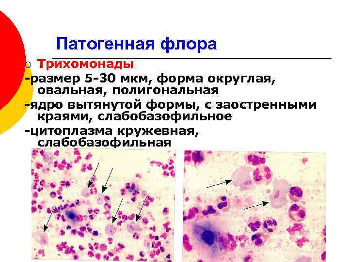 Условно патогенная микрофлора это. Патогенная микрофлора человека. Условно патогенная микрофлора в гинекологии.