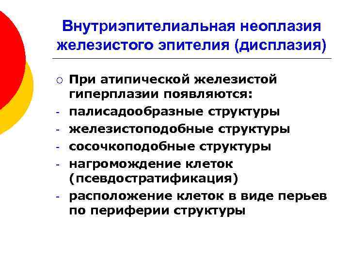 Внутриэпителиальная неоплазия железистого эпителия (дисплазия) ¡ - При атипической железистой гиперплазии появляются: палисадообразные структуры