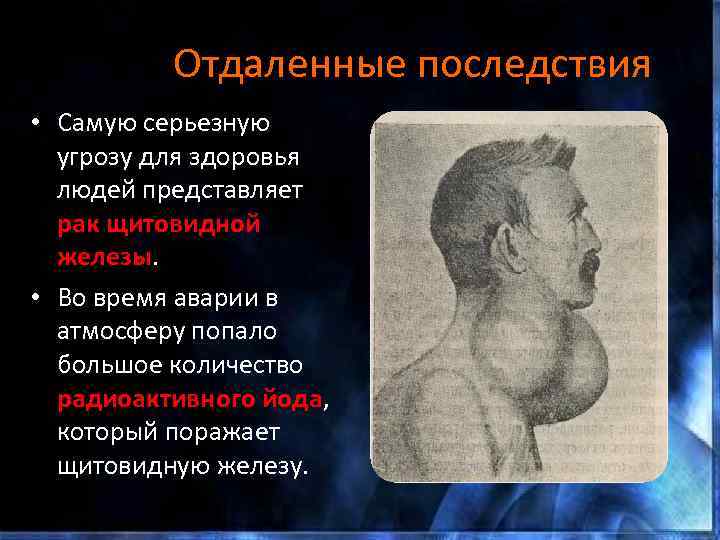 Отдаленные последствия • Самую серьезную угрозу для здоровья людей представляет рак щитовидной железы. •