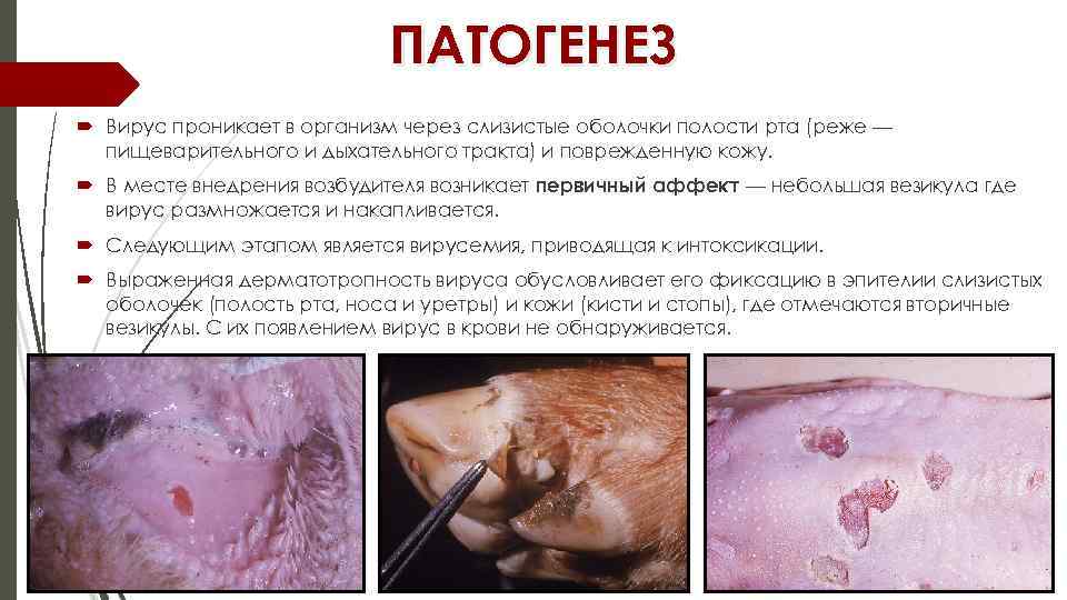 ПАТОГЕНЕЗ Вирус проникает в организм через слизистые оболочки полости рта (реже — пищеварительного и