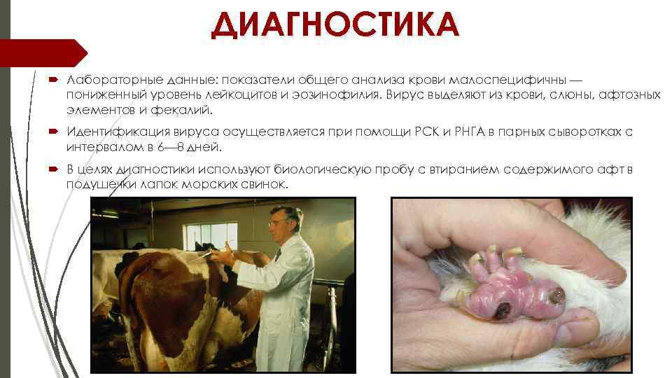 ДИАГНОСТИКА Лабораторные данные: показатели общего анализа крови малоспецифичны — пониженный уровень лейкоцитов и эозинофилия.