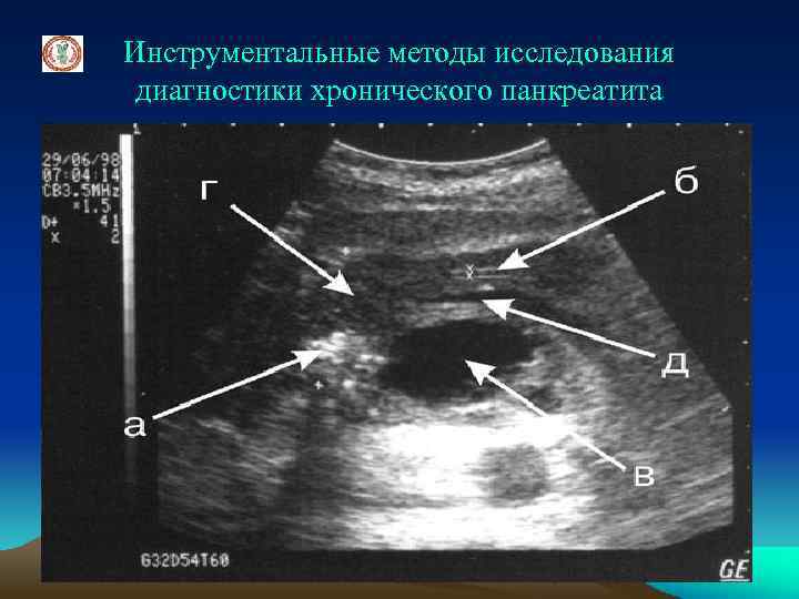 Инструментальные методы исследования диагностики хронического панкреатита 