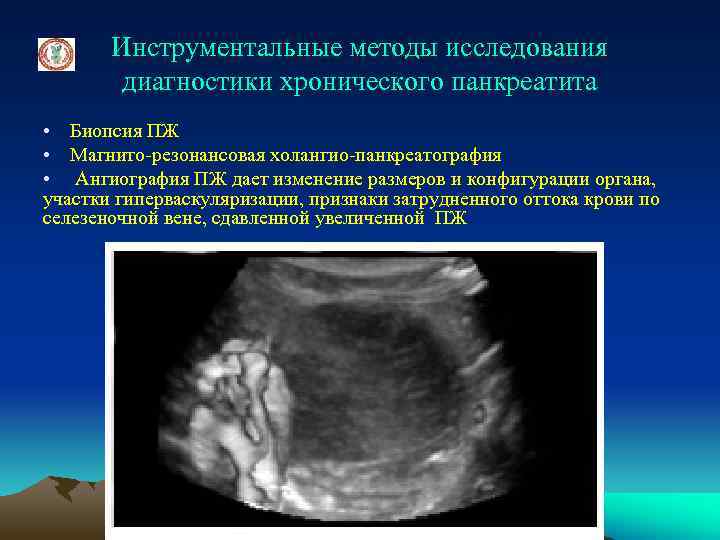 Инструментальные методы исследования диагностики хронического панкреатита • Биопсия ПЖ • Магнито-резонансовая холангио-панкреатография • Ангиография