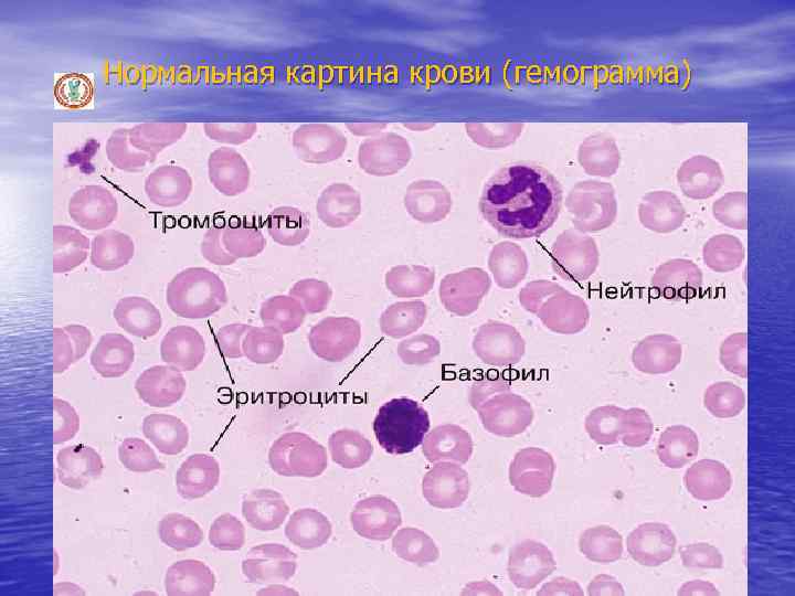 Нормальная картина крови (гемограмма) 