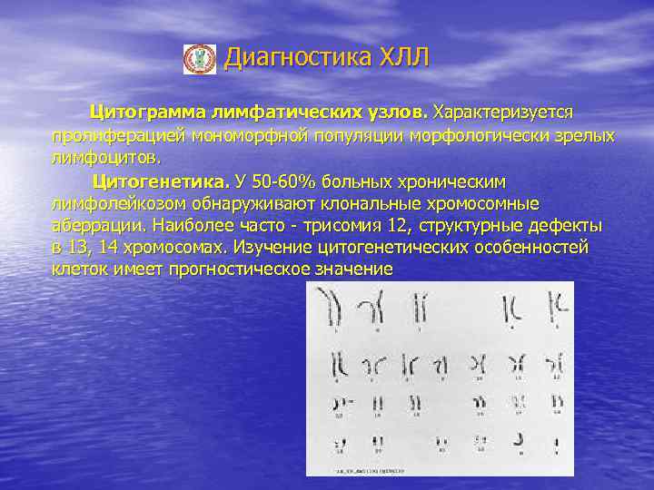 Диагностика ХЛЛ Цитограмма лимфатических узлов. Характеризуется пролиферацией мономорфной популяции морфологически зрелых лимфоцитов. Цитогенетика. У