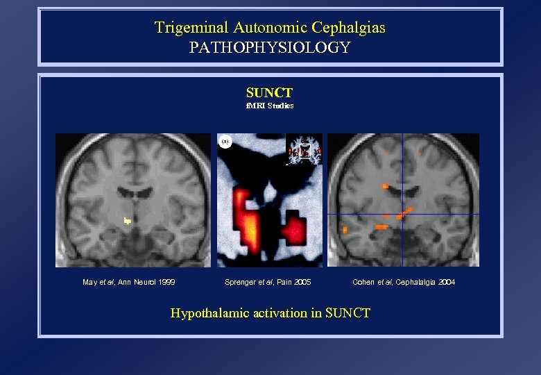 Trigeminal Autonomic Cephalgias PATHOPHYSIOLOGY SUNCT f. MRI Studies May et al, Ann Neurol 1999