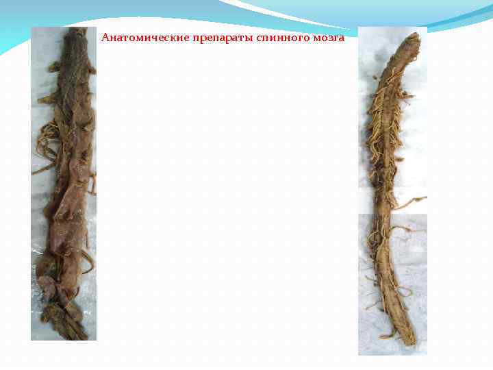 Анатомические препараты спинного мозга 