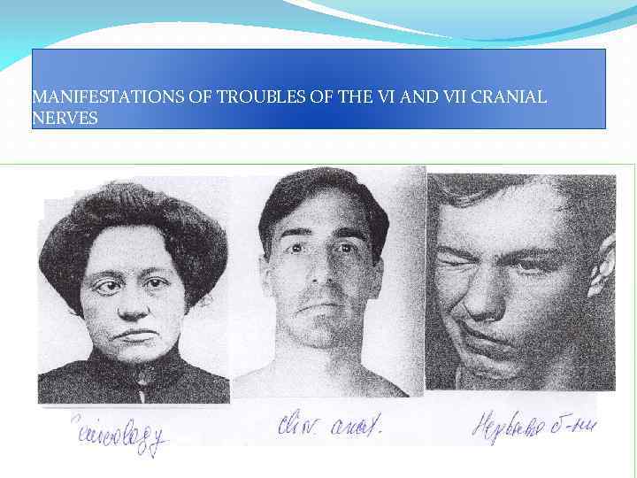 MANIFESTATIONS OF TROUBLES OF THE VI AND VII CRANIAL NERVES 