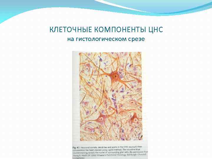 КЛЕТОЧНЫЕ КОМПОНЕНТЫ ЦНС на гистологическом срезе 