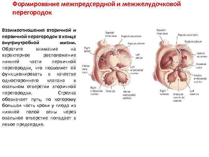 Формирование межпредсердной и межжелудочковой перегородок Взаимоотношения вторичной и первичной перегородок в конце внутриутробной жизни.