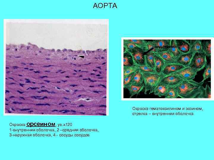 АОРТА эндотелий Окраска гематоксилином и эозином, стрелка – внутренняя оболочка Окраска орсеином, ув. х120