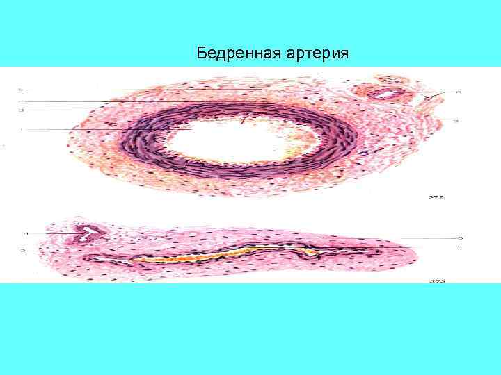 Бедренная артерия 