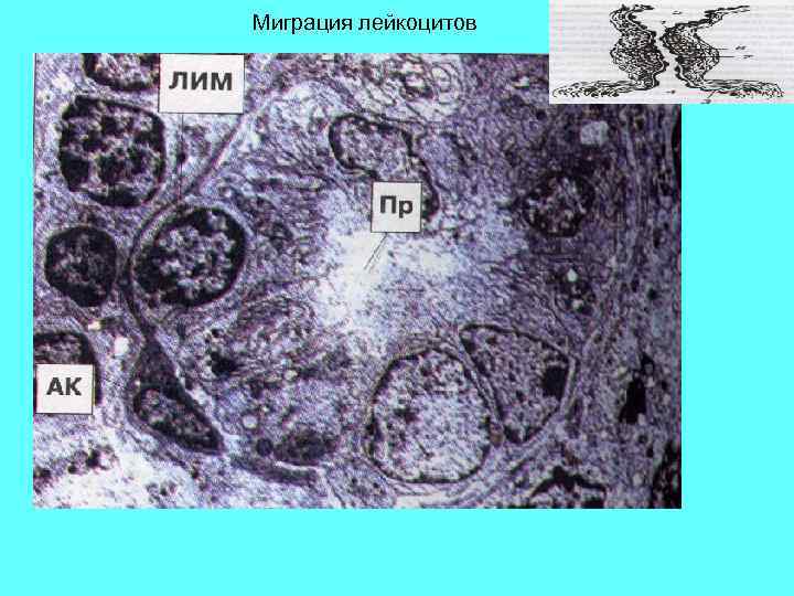 Миграция лейкоцитов 