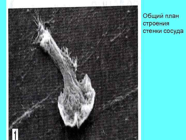 Общий план строения стенки сосуда 