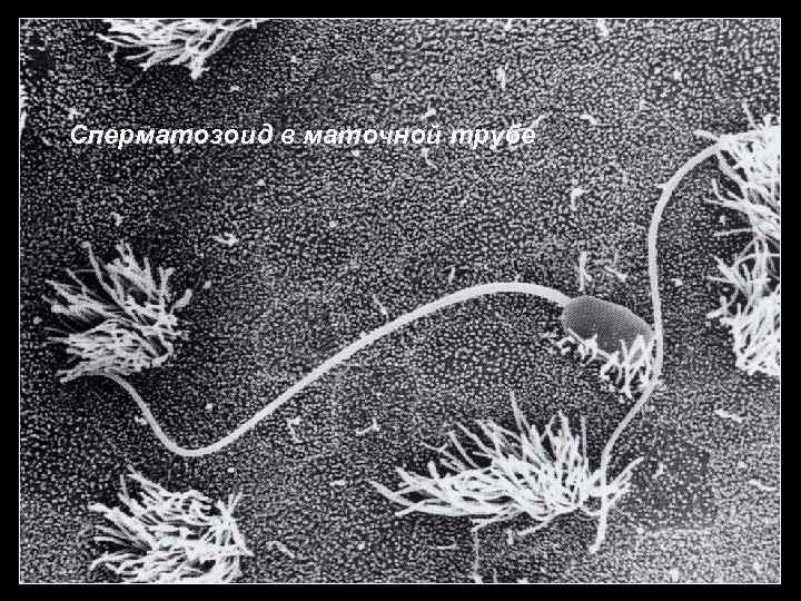 Сперматозоид в маточной трубе 