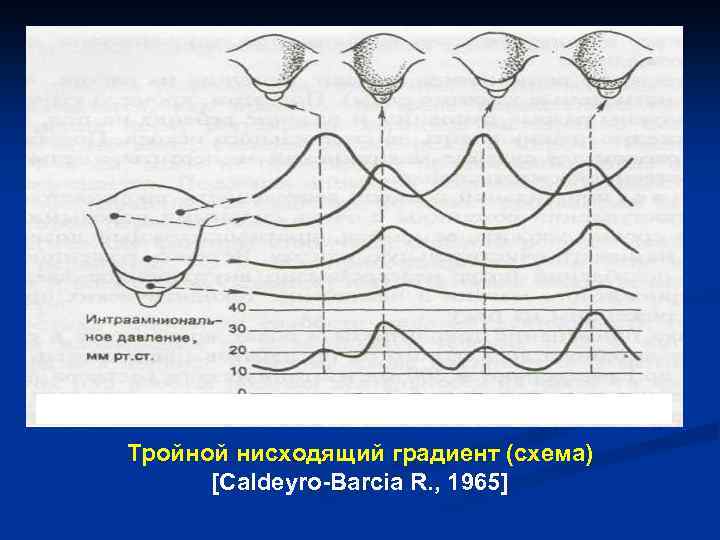 Тройной нисходящий градиент (схема) [Caldeyro-Barcia R. , 1965] 