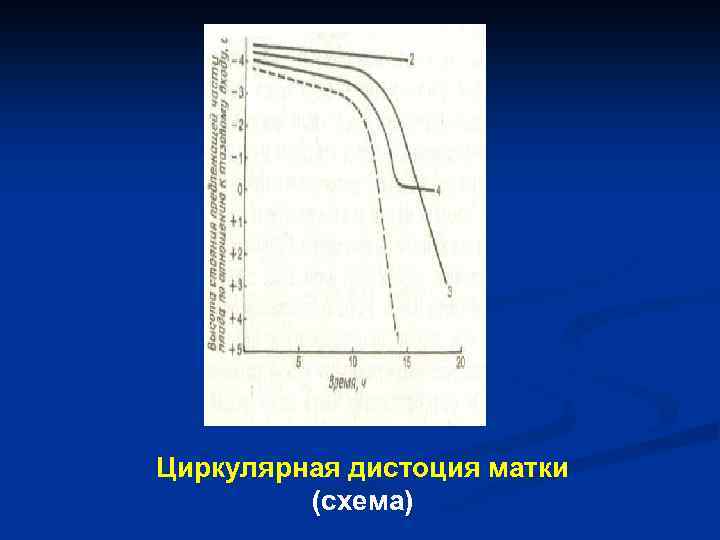 Циркулярная дистоция матки (схема) 