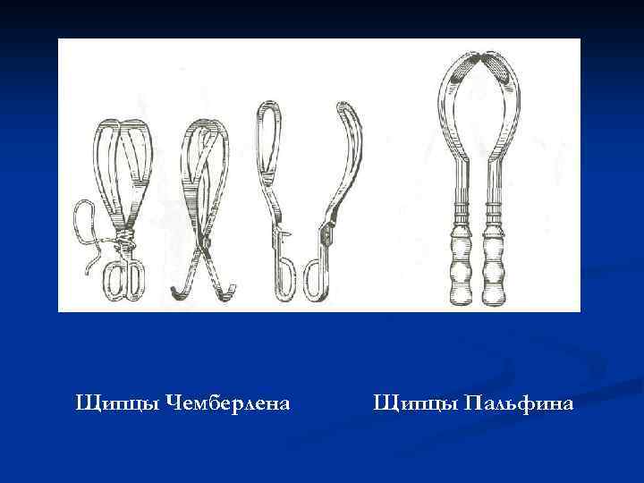 Щипцы Чемберлена Щипцы Пальфина 