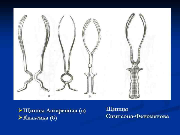 ØЩипцы Лазаревича (а) ØКилленда (б) Щипцы Симпсона-Феноменова 
