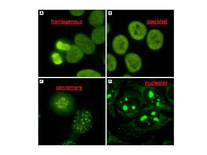 homogenous cenromere speckled nucleolar 