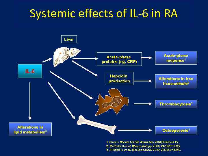 Systemic effects of IL-6 in RA Liver Acute-phase proteins (eg, CRP) IL-6 Hepcidin production