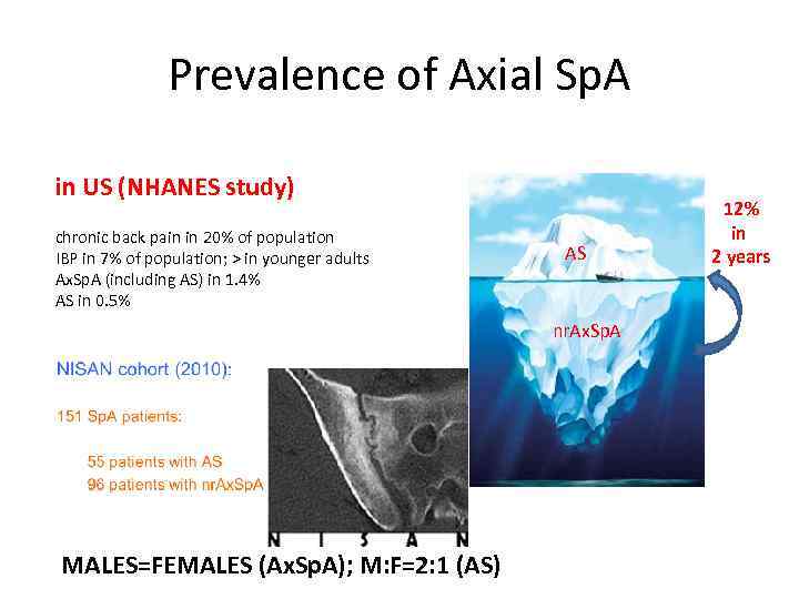 Prevalence of Axial Sp. A in US (NHANES study) chronic back pain in 20%