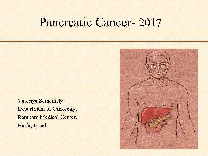 Pancreatic Cancer- 2017 Valeriya Semenisty Department of Oncology, Rambam Medical Center, Haifa, Israel 