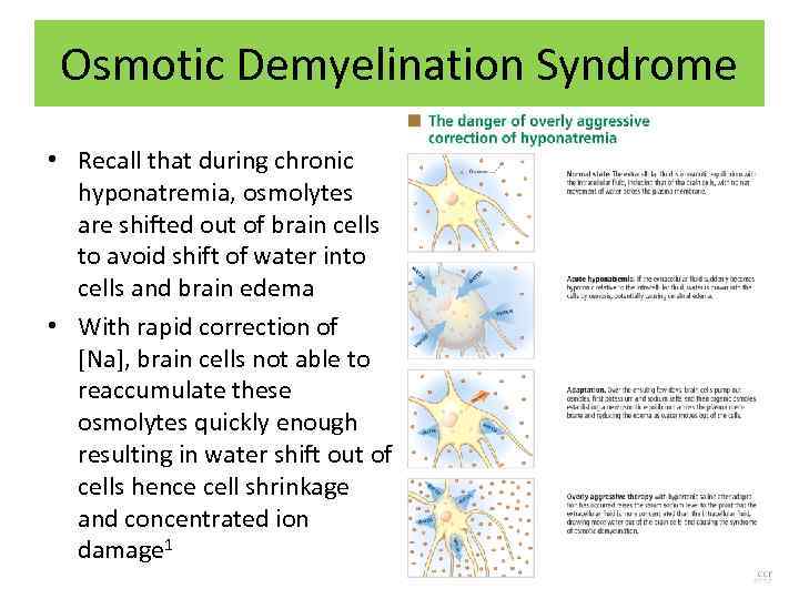 Osmotic Demyelination Syndrome • Recall that during chronic hyponatremia, osmolytes are shifted out of